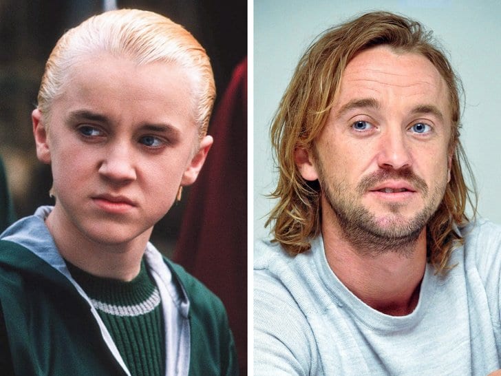 Hur Ser Harry Potter Ut Nu